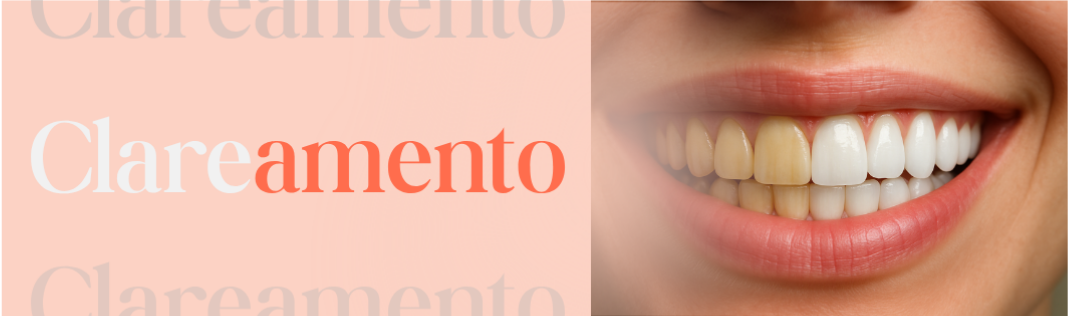 Clareamento